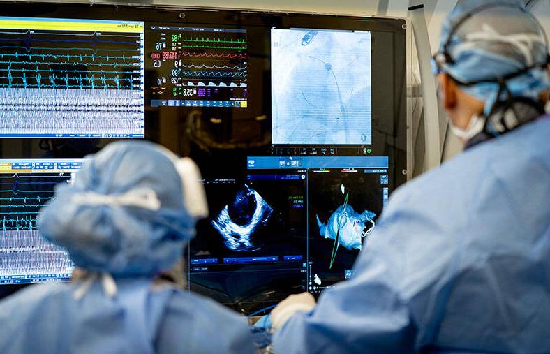 Doctors using pulsed field ablation (PFA) to treat Afib